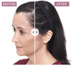 Animated photo of the before and after results when using the Keranique Hair Regrowth Treatment Spray